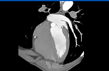 CT 사진4