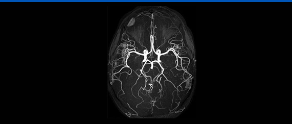 MRI 사진1