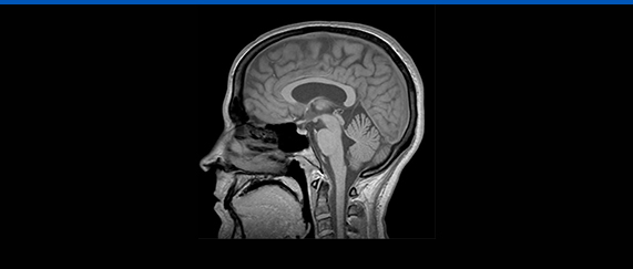 MRI 사진2