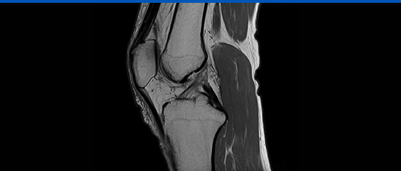 MRI 사진3