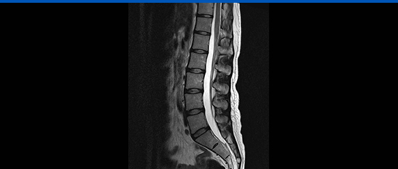 MRI 사진4