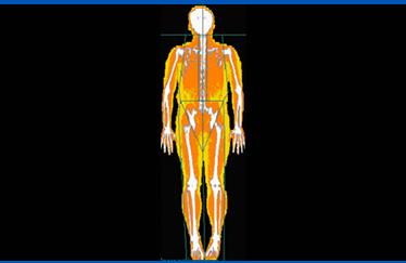 골밀도 사진1