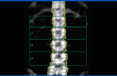 골밀도 사진5